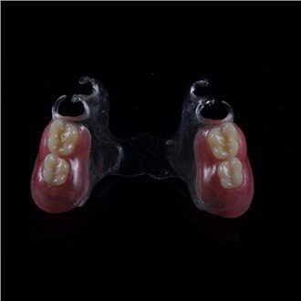 Protesi parziale rimovibile in acrilico