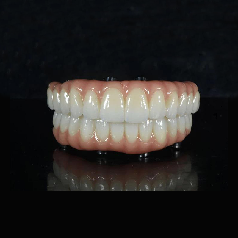 PONTE ALL-ON -X IN ZIRCONIA