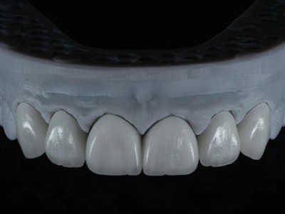 Come esternalizzare il lavoro di un tecnico di laboratorio odontoiatrico all'...