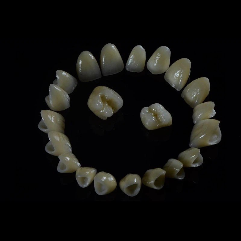 Corona in zirconia stratificata