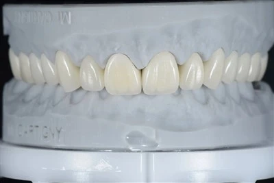 Premi la corona E-max